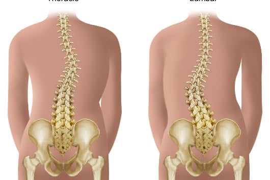 types-of-scoliosis