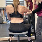 Μέθοδος Schroth για την σκολίωση (ISST - Schroth Therapist)